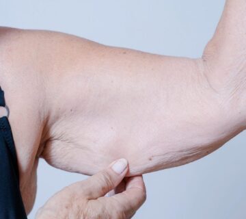 Sarcopenia 360x320