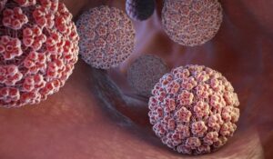 A promising frontier in HPV treatment 300x175